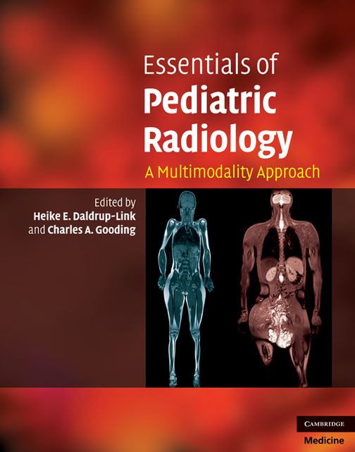 Essentials of Pediatric Radiology: A Multimodality Approach