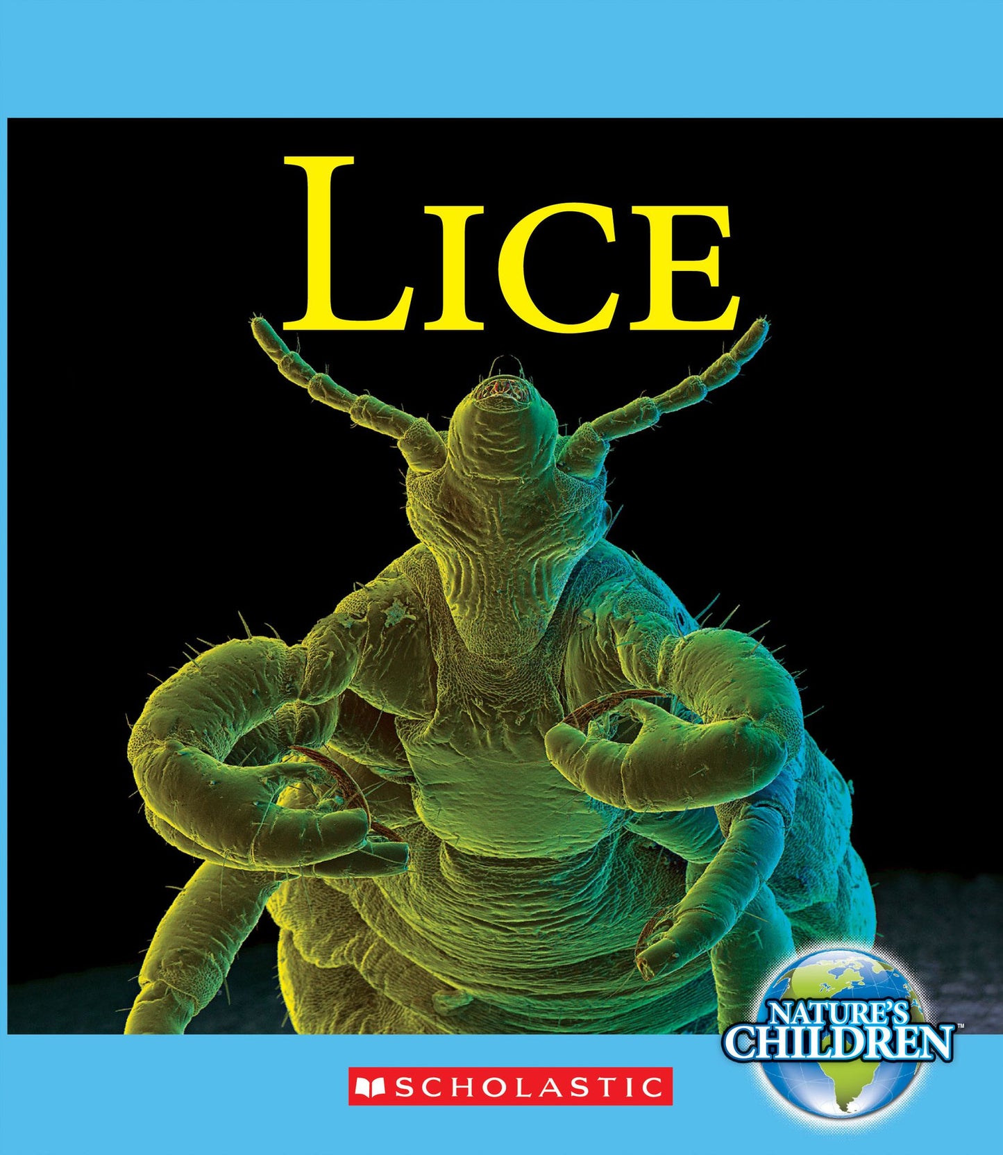 Lice