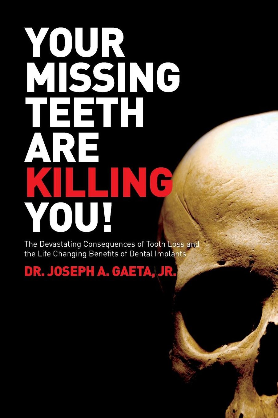 Your Missing Teeth Are Killing You!: The Devastating Consequences of Tooth Loss and the Life Changing Benefits of Dental Implants