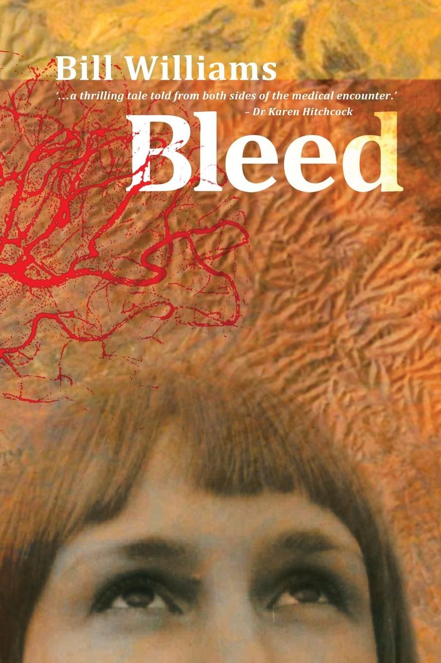 Bleed