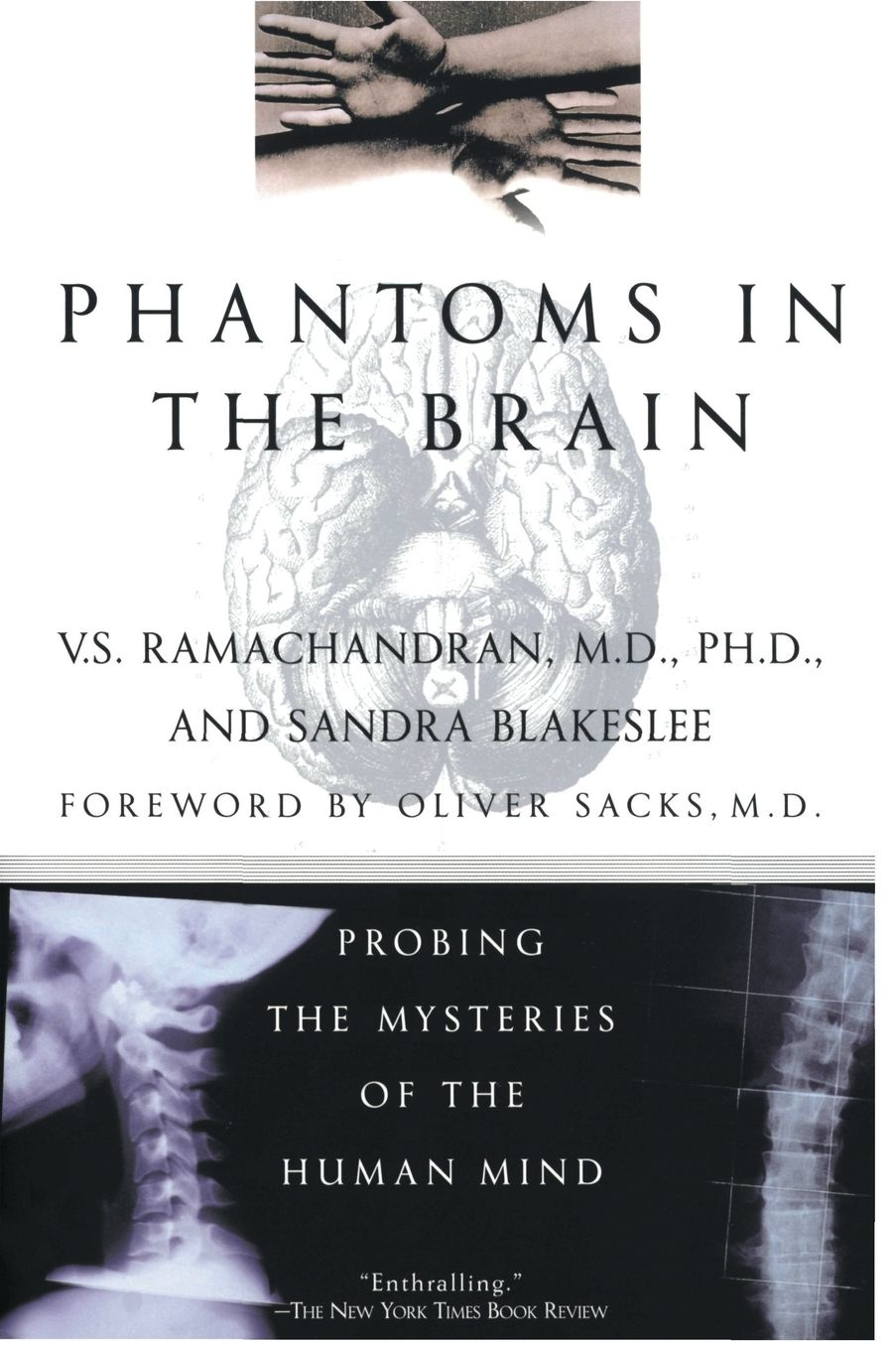 Phantoms in the Brain: Probing the Mysteries of the Human Mind