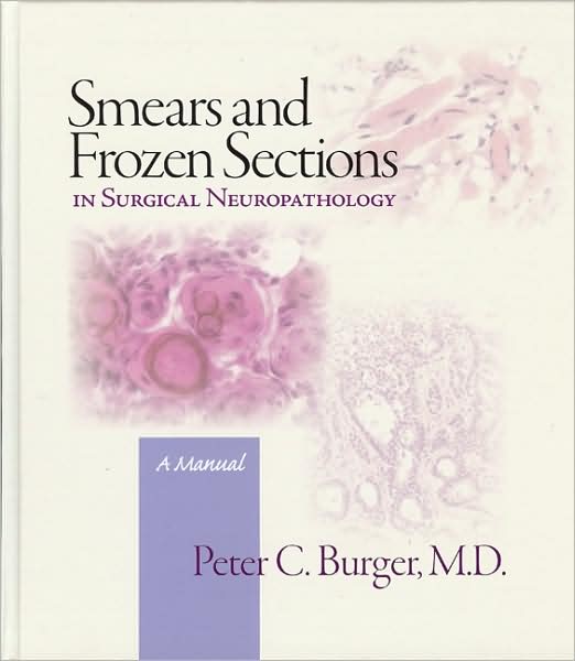 Smears and Frozen Sections in Surgical Neuropathology: A manual