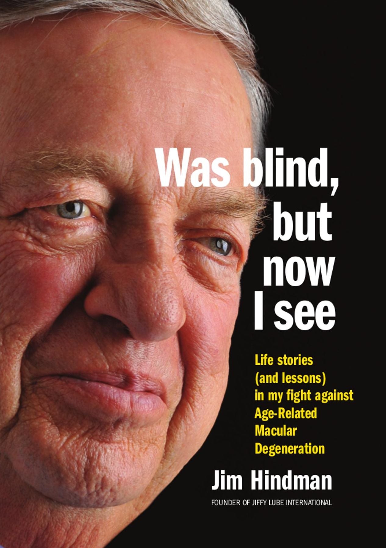 Was blind, but now I see: Life stories (and lessons) from my battle with Age-Related Macular Degeneration
