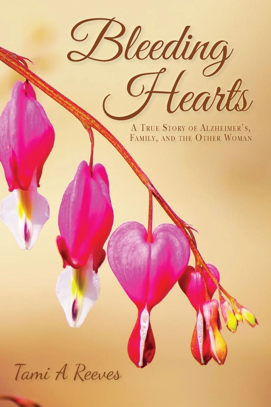 Bleeding Hearts: A True Story of Alzheimer's, Family, and the Other Woman