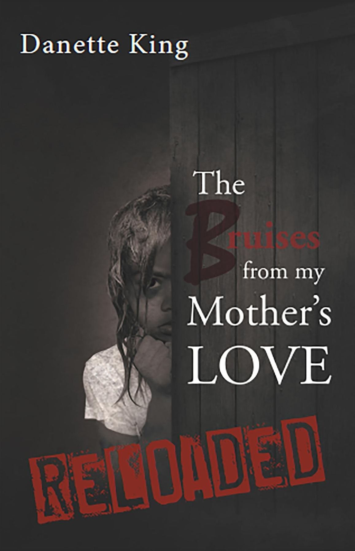 The Bruises from my Mother's Love