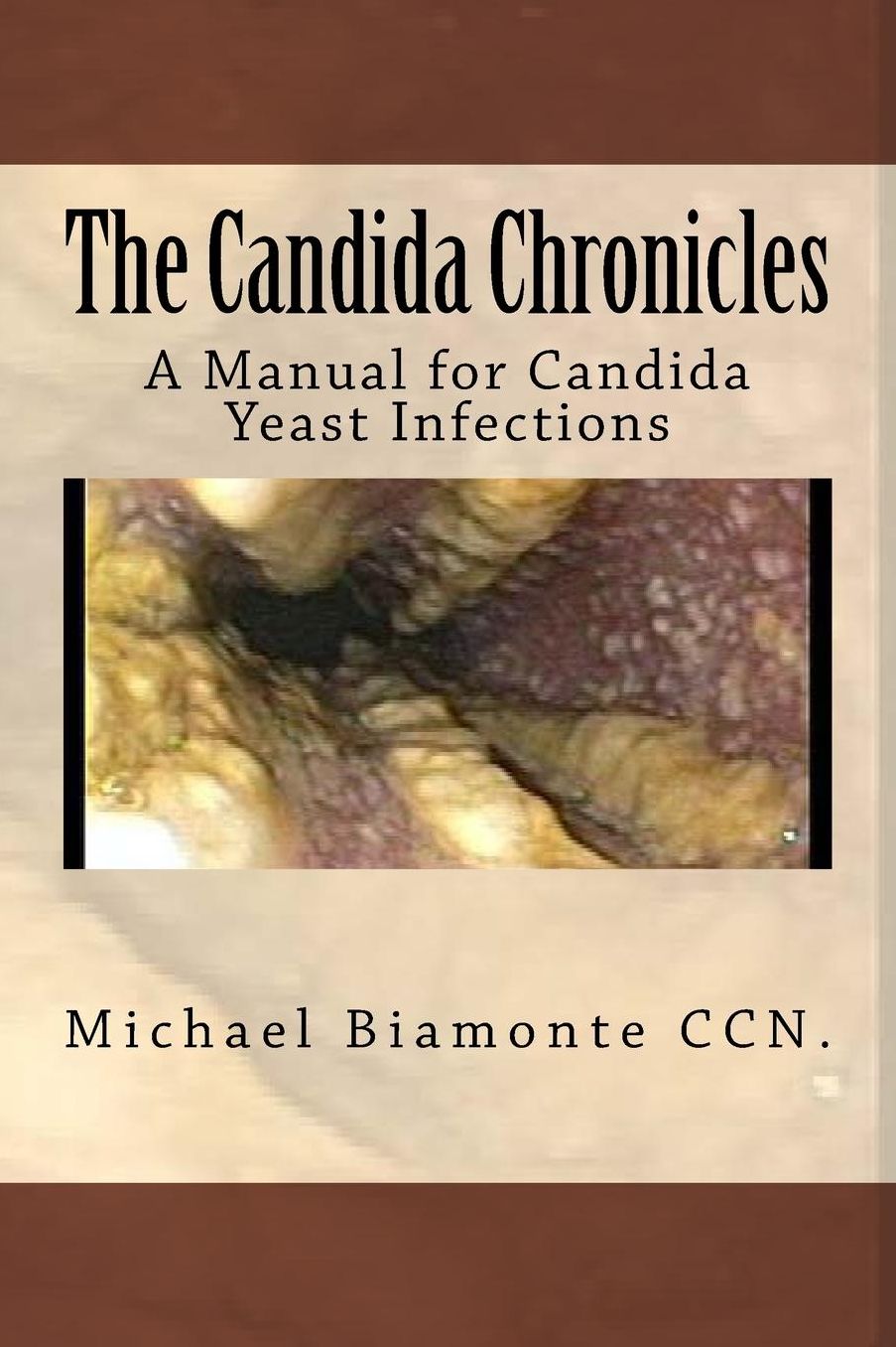 The Candida Chronicles: A Mannual for Candida/Yeast infections
