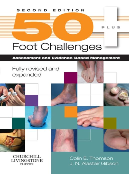 50+ Foot Challenges E-Book: Assessment and Evidence-Based Management
