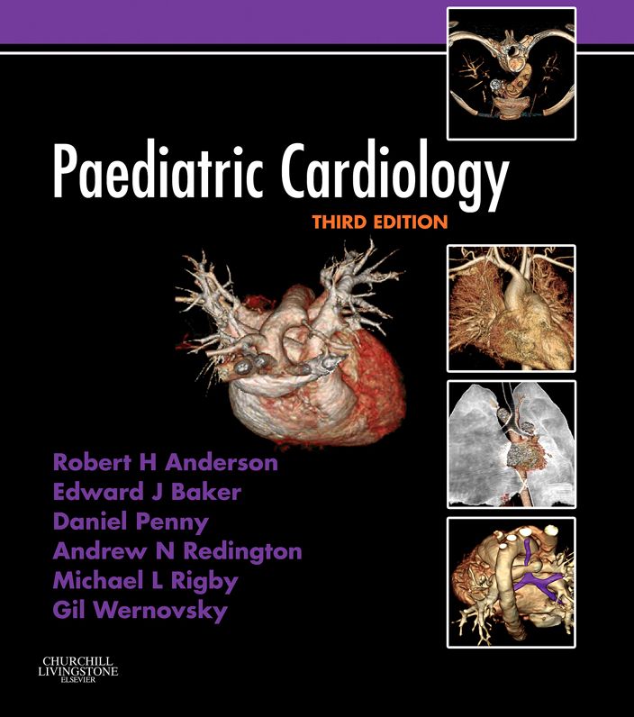 Paediatric Cardiology: Expert Consult - Online and Print