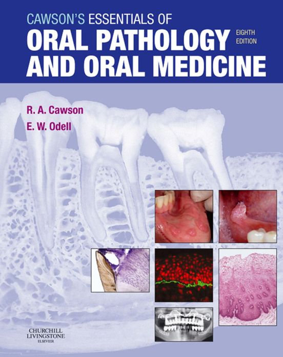 Cawson's Essentials of Oral Pathology and Oral Medicine E-Book