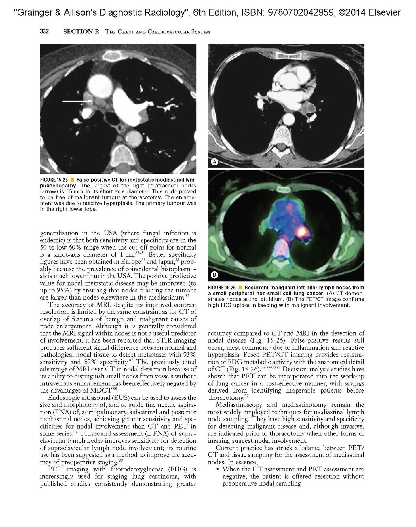 Grainger & Allison's Diagnostic Radiology