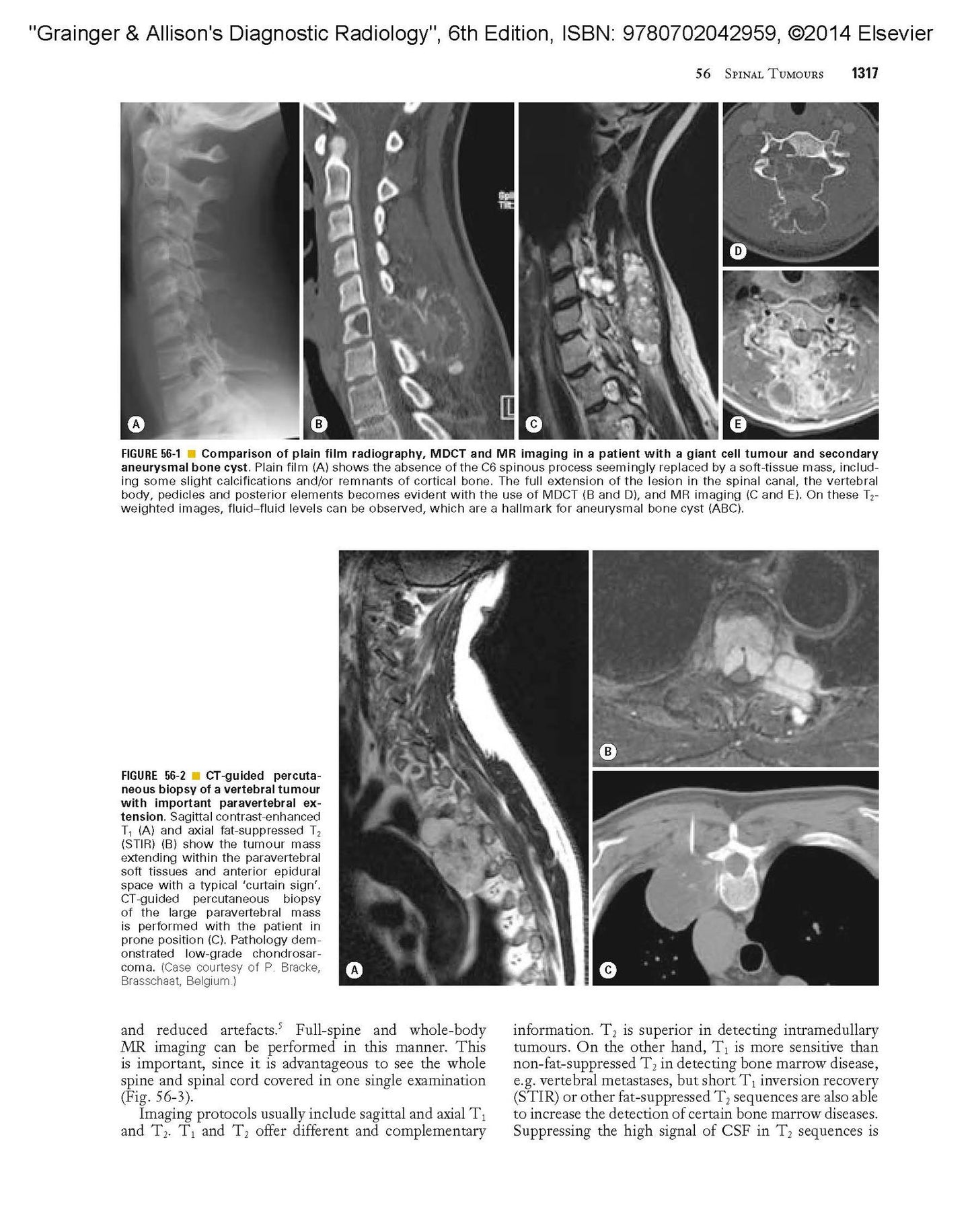 Grainger & Allison's Diagnostic Radiology