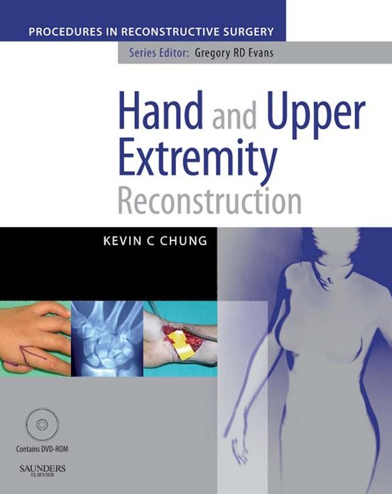 Hand And Upper Extremity Reconstruction E-Book: A Volume in the Procedures in Reconstructive Surgery Series