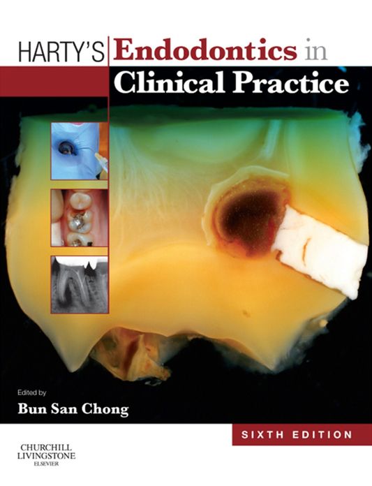 Harty's Endodontics in Clinical Practice - Elsevieron VitalSource