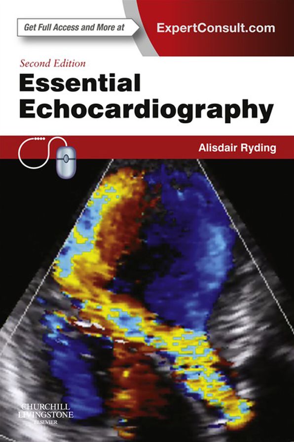 Essential Echocardiography - E-Book: Expert Consult - Online & Print
