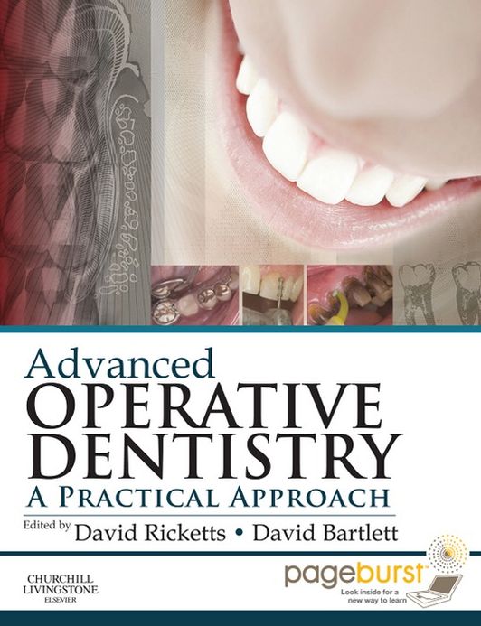 Advanced Operative Dentistry E-Book: A Practical Approach
