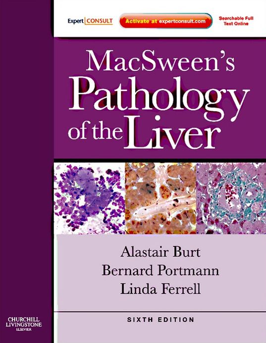 MacSween's Pathology of the Liver E-Book
