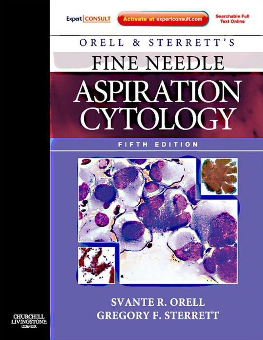 Orell, Orell and Sterrett's Fine Needle Aspiration Cytology E-Book: Expert Consult