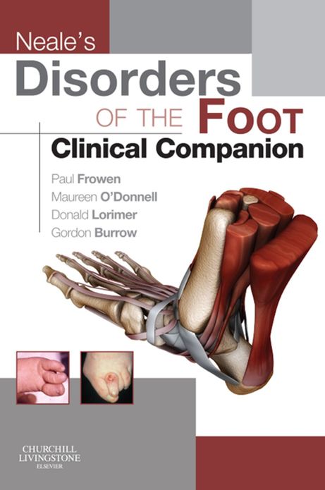 Neale's Disorders of the Foot Clinical Companion E-Book