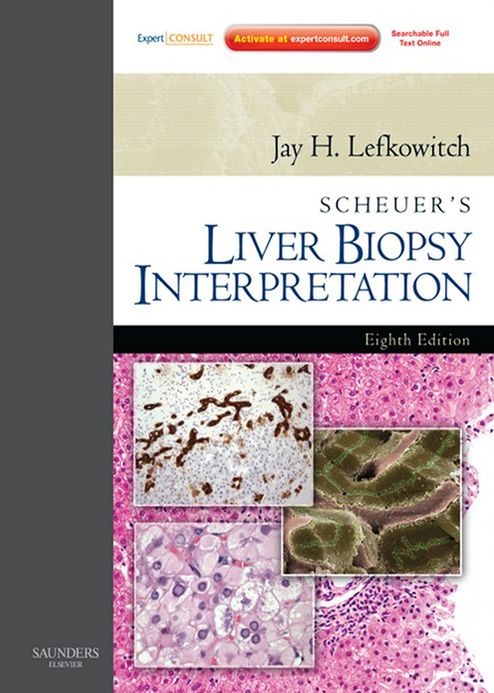 Scheuer's Liver Biopsy Interpretation E-Book