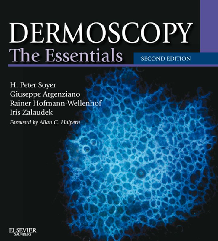 Dermoscopy E-Book