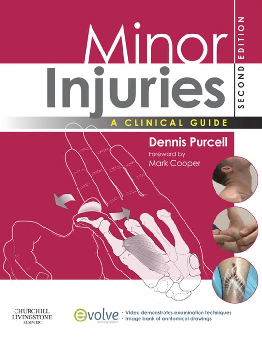 Minor Injuries E-Book: A Clinical Guide for Nurses