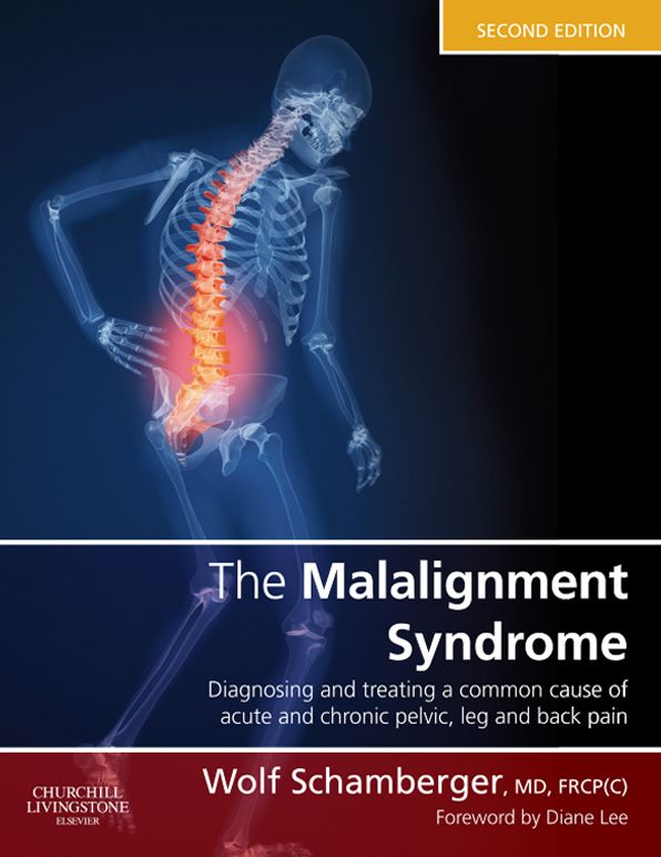The Malalignment Syndrome E-Book: Implications for Medicine and Sport