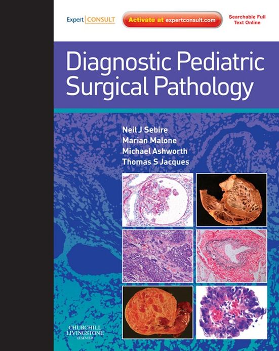 Diagnostic Pediatric Surgical Pathology E-Book: Expert Consult--Online and Print