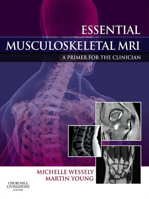 Essential Musculoskeletal MRI E-Book: A Primer for the Clinician
