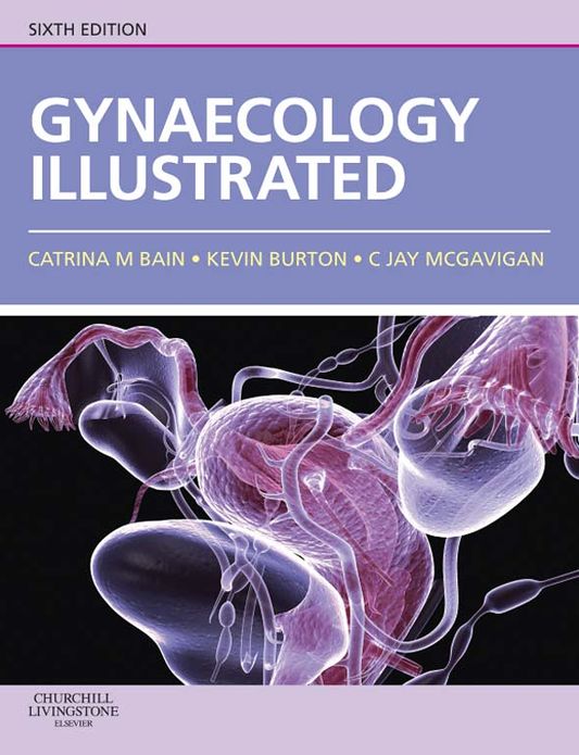 Gynaecology Illustrated E-Book
