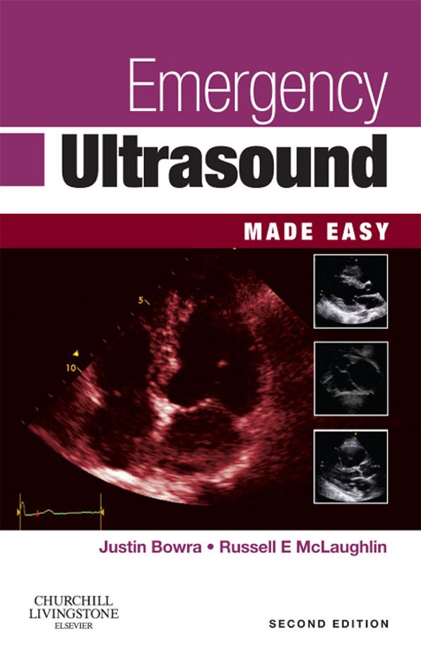 Emergency Ultrasound Made Easy E-Book