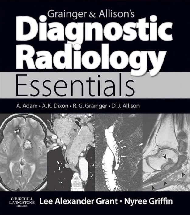 Grainger & Allison's Diagnostic Radiology Essentials E-Book