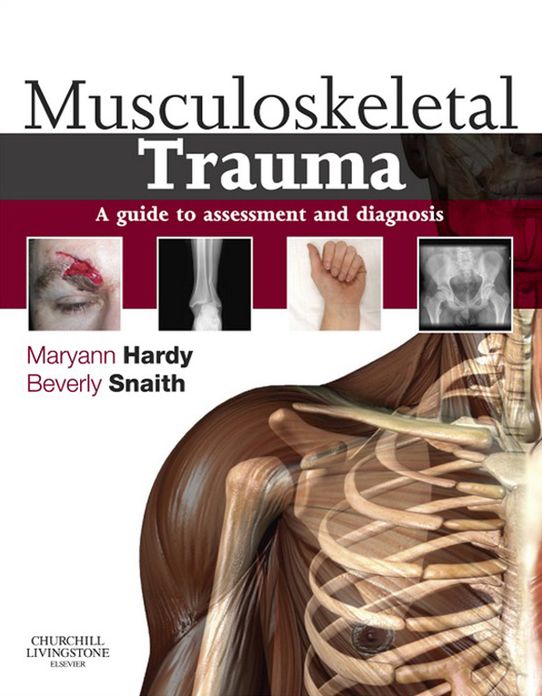 Musculoskeletal Trauma E-Book: a guide to assessment and diagnosis