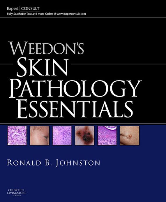 Weedon's Skin Pathology Essentials E-Book: Expert Consult: Online and Print