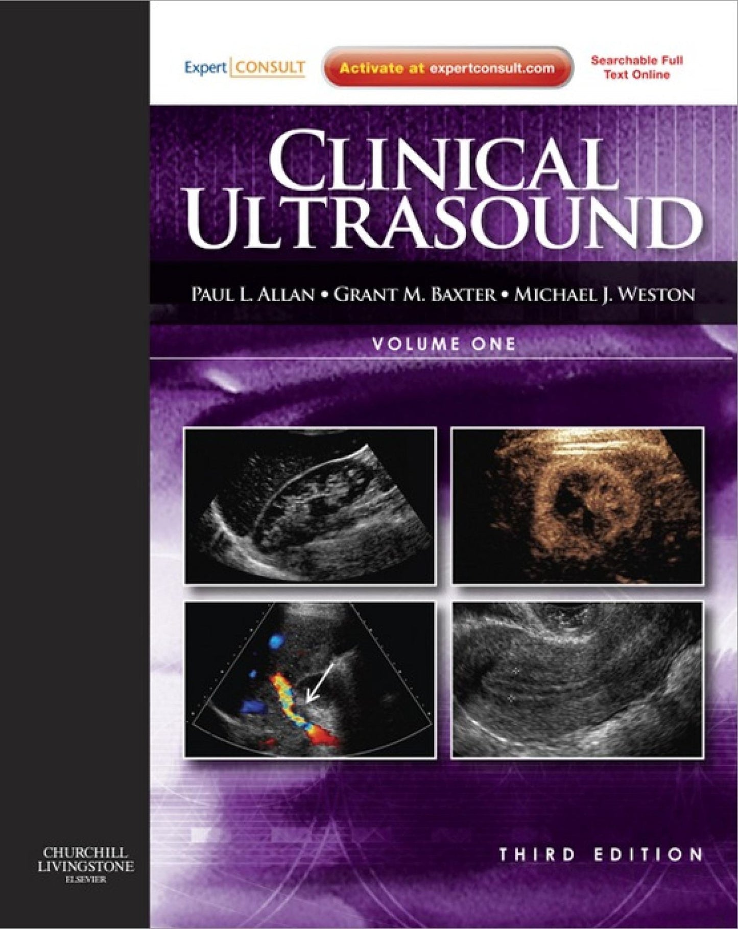 Clinical Ultrasound, 2-Volume Set E-Book: Expert Consult: Online and Print