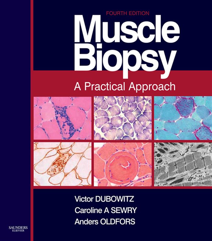 Muscle Biopsy E-Book: A Practical Approach