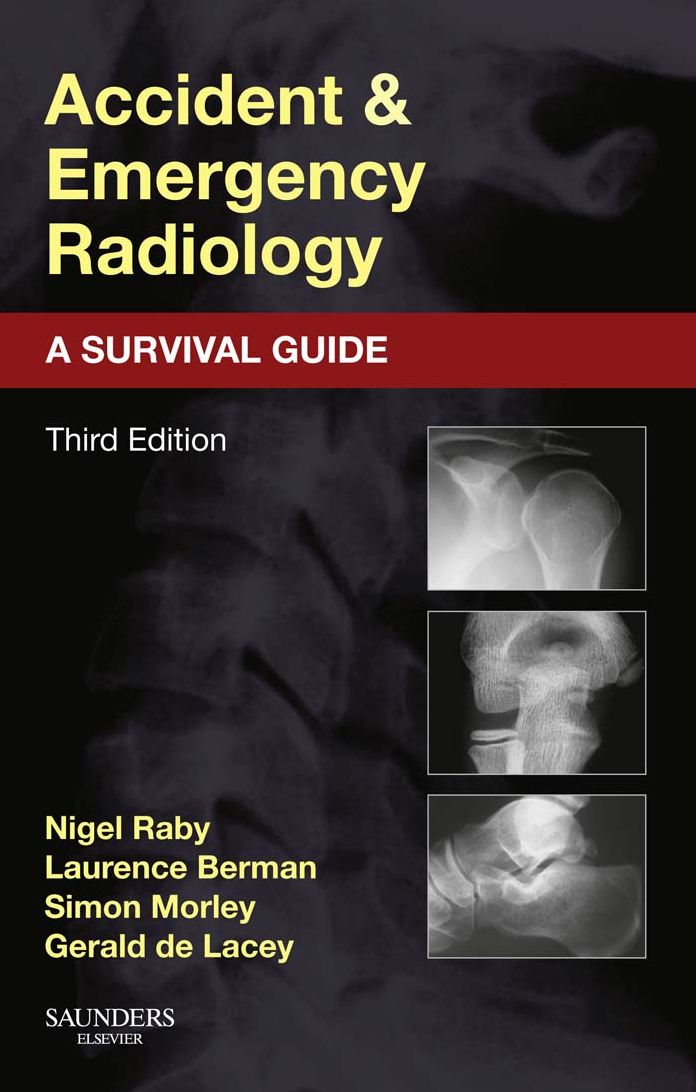 Accident and Emergency Radiology: A Survival Guide E-Book