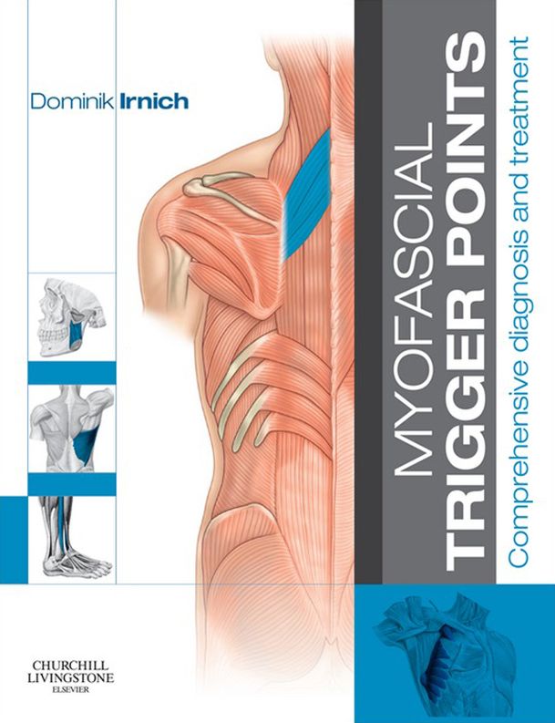Myofascial Trigger Points - E-Book: Comprehensive diagnosis and treatment