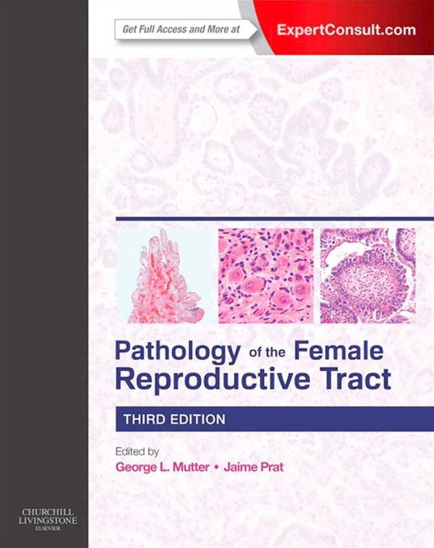 Pathology of the Female Reproductive Tract E-Book