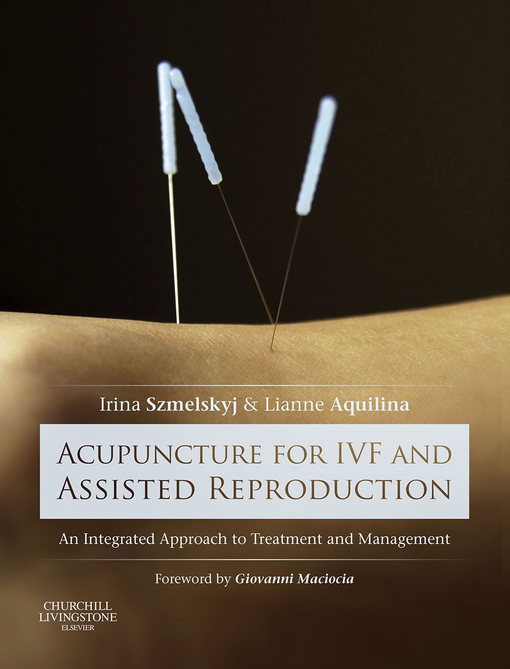 Acupuncture for IVF and Assisted Reproduction - E-Book: An integrated approach to treatment and management
