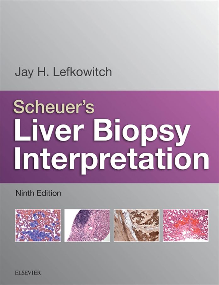 Scheuer's Liver Biopsy Interpretation E-Book