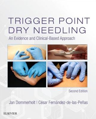 Trigger Point Dry Needling: An Evidence and Clinical-Based Approach