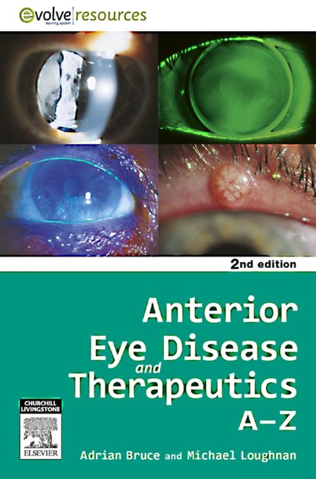 Anterior Eye Disease and Therapeutics A-Z - E-Book