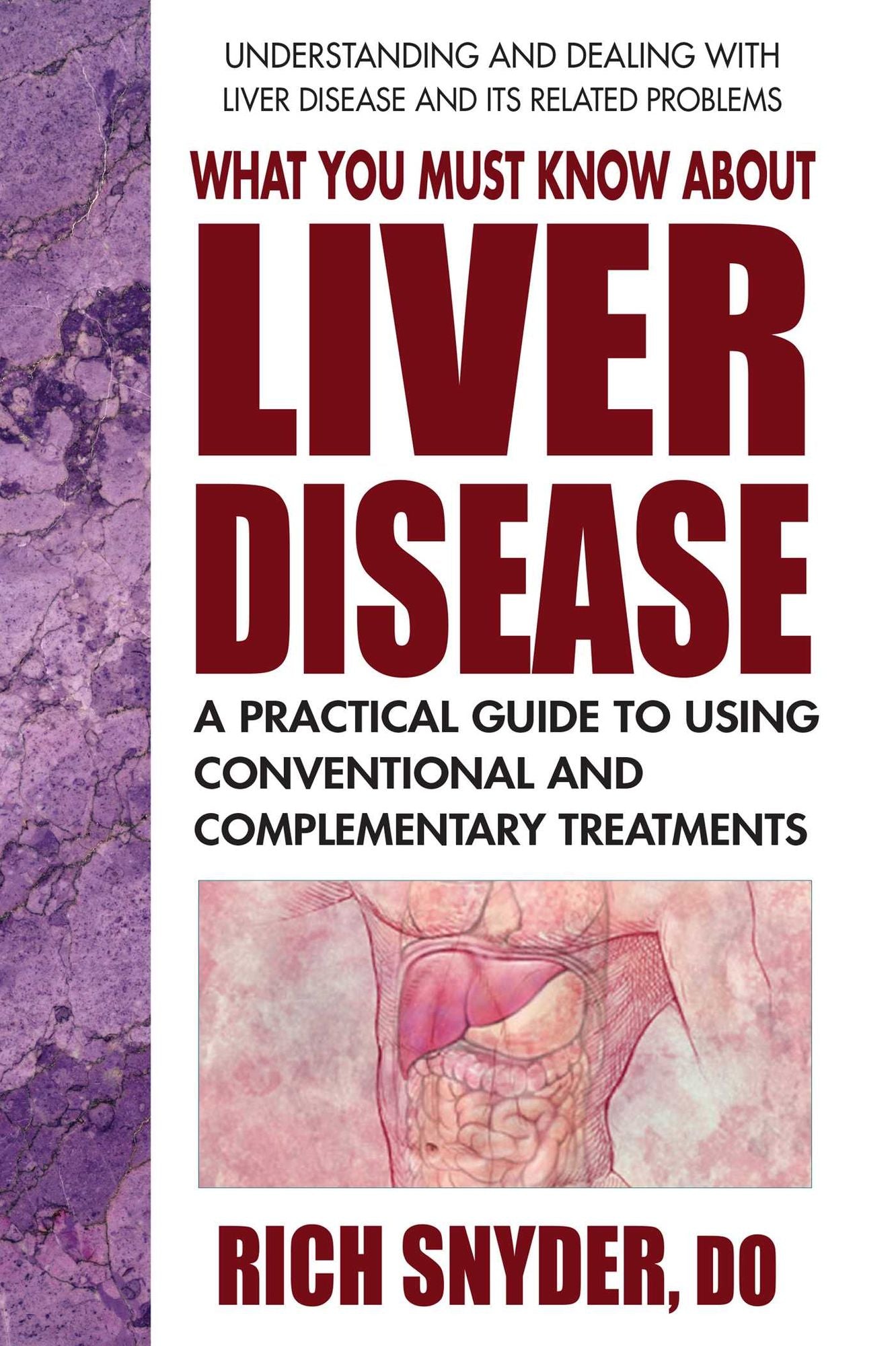 What You Must Know About Liver Disease: A Practical Guide to Using Conventional and Complementary Treatments