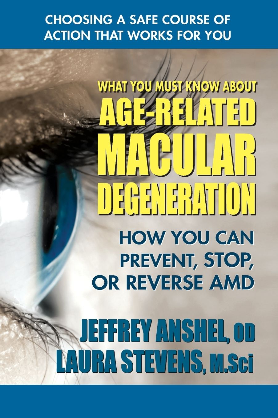 What You Must Know About Age-Related Macular Degeneration: How You Can Prevent, Stop, or Reverse AMD
