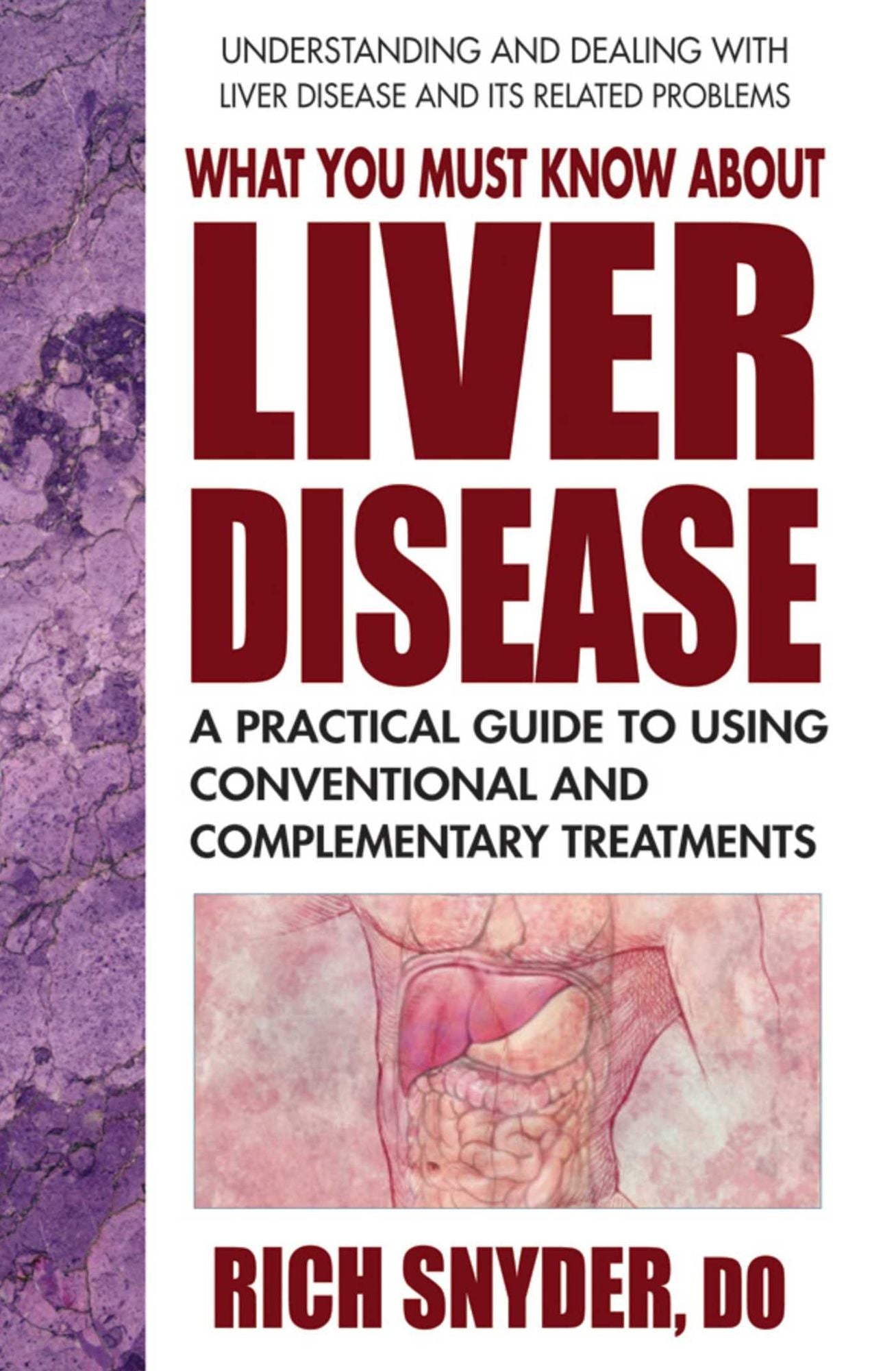 What You Must Know About Liver Disease: A Practical Guide to Using Conventional and Complementary Treatments