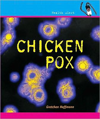 Chickenpox