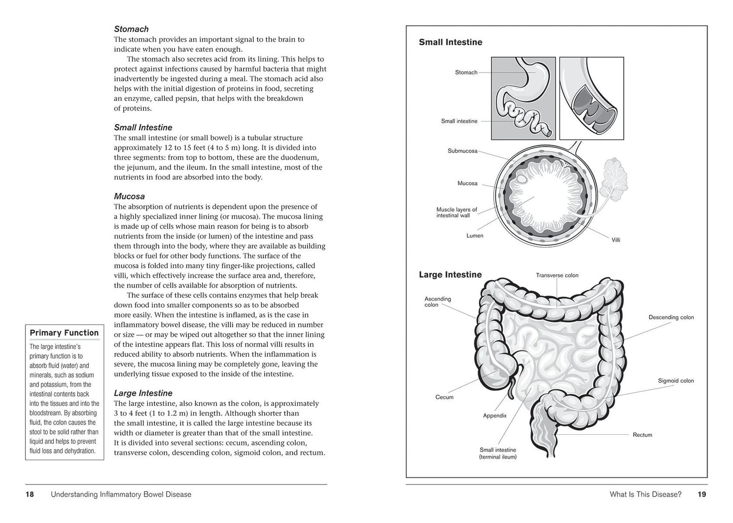 Crohn's and Colitis: Understanding and Managing Ibd