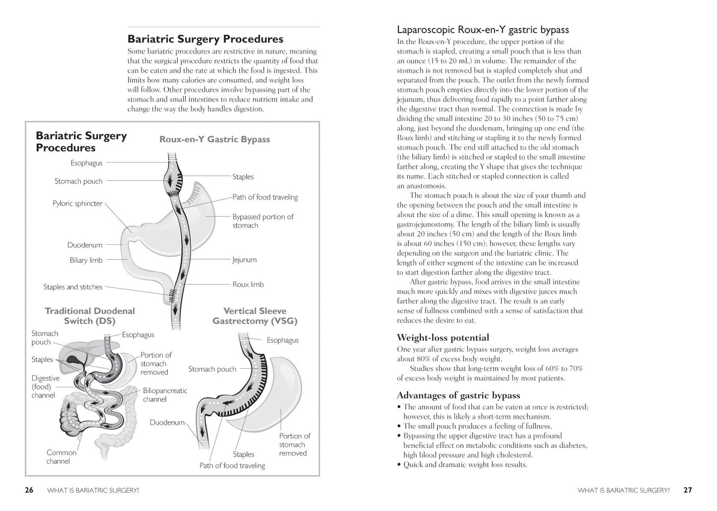 The Complete Bariatric Surgery Guide and Diet Program: Includes 150 Recipes for Lifelong Weight-Loss Success
