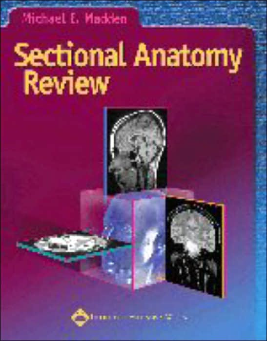 Sectional Anatomy Review
