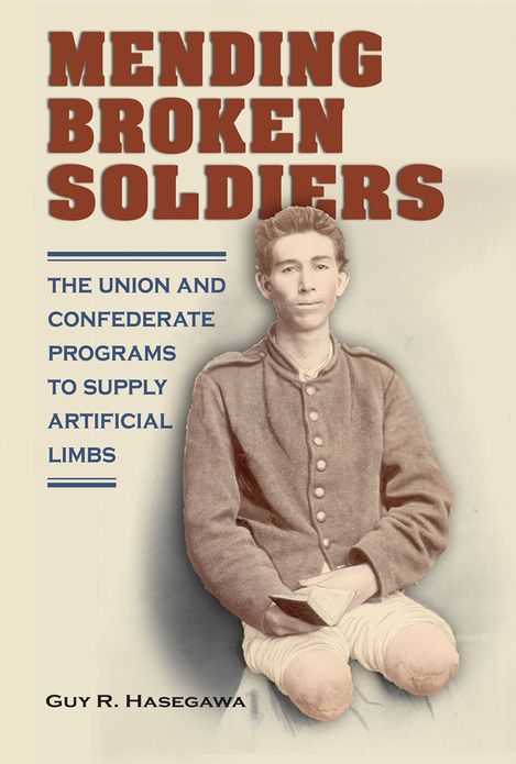 Mending Broken Soldiers: The Union and Confederate Programs to Supply Artificial Limbs